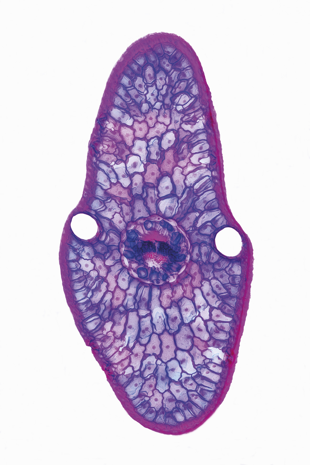 Fichtennadel (Picea abies), quer, gefärbt