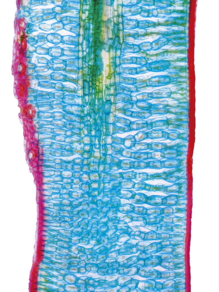 Fichtennadel (Picea sp.) Radialschnitt gefärbt