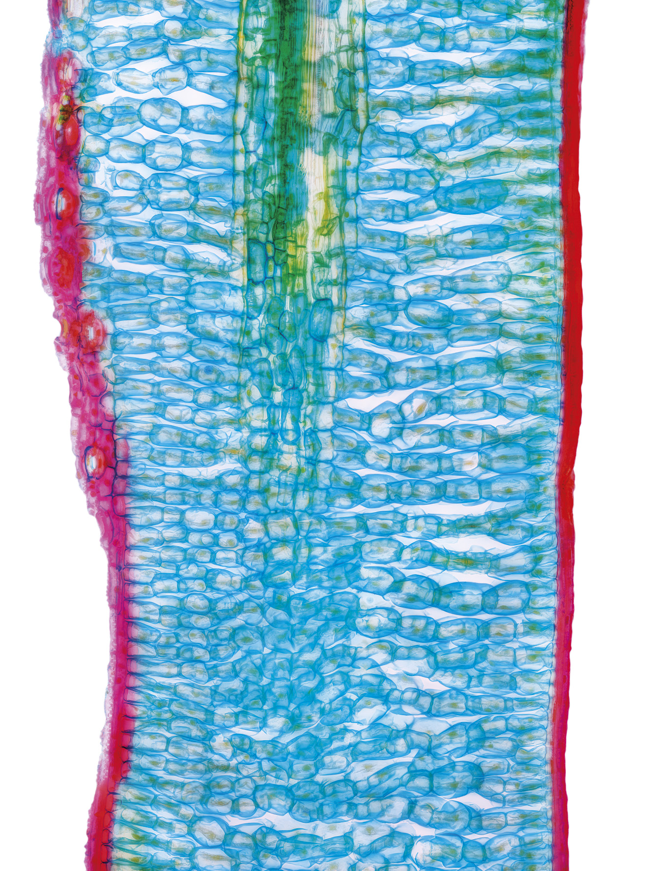 Fichtennadel (Picea sp.) Radialschnitt gefärbt